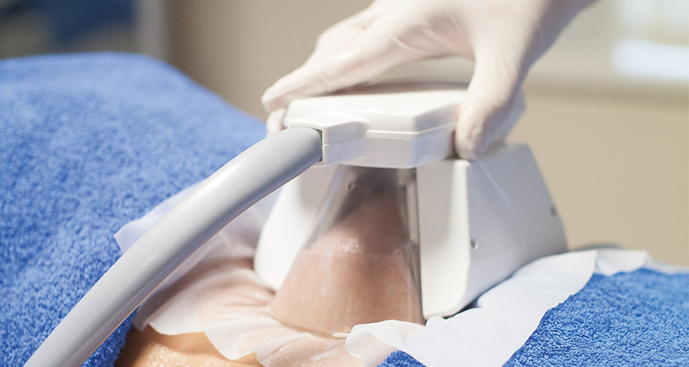 How Fat Freezing and HIFU Work Together? 2 Multiple Areas in One Session HIFU and Fat Freezing Walton on the Hill