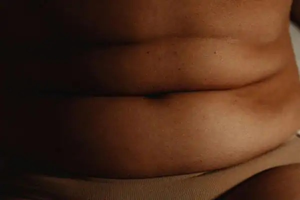 The Hidden Connection: How Stress Shapes Your Fitness and Body Composition 3 image of what stress can do on the stomach area and how Lipo 360 Walton on the Hill can help to change your body shape.